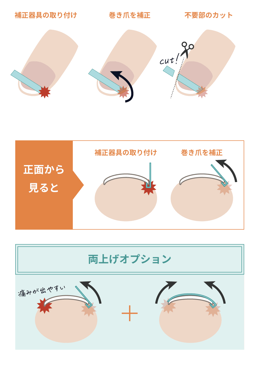 施術の方法