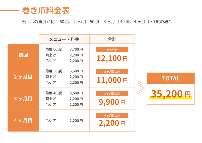 巻き爪料金の一例