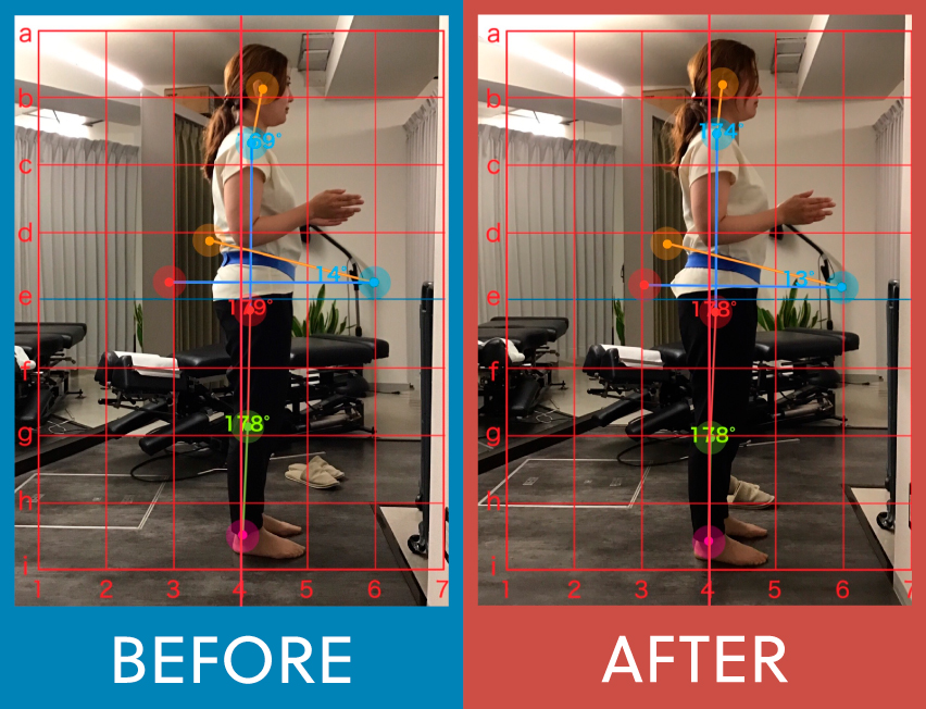 施術後の骨盤角度変化2